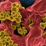 Bakterien unter dem Elektronenmikroskop, Stichwort Darm. (c) Pixabay.com