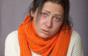 Das Gesicht einer kranken Frau, Stichwort Schleim im Husten. (c) Pixabay.com