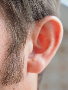 Ratgeber: So entfernen sie das "Schmalz in den Ohren" richtig 1 Nahaufnahme eines Ohres, Stichwort Ratgeber zum Entfernen von Ohrenschmalz. (c) Pixabay.com