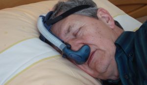 Das Gesicht eines schlafenden Mannes mit einer Vorrichtung gegen Schnarchen, Stichwort Schlafapnoe.  (c) Hoza