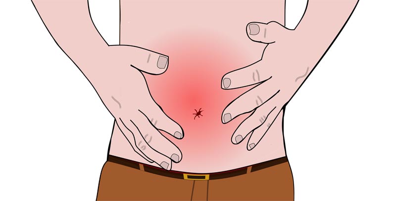 Grafik: ein Mann mit schmerzend rotem Bauch. (c) Pixabay.com