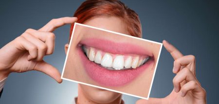 Eine Frau, die ein Bild ihres lächelnden Mundes vor ihrem Gesicht hält. (c) Pixabay.com