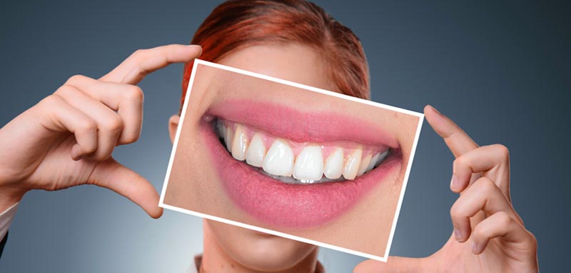 Eine Frau, die ein Bild ihres lächelnden Mundes vor ihrem Gesicht hält. (c) Pixabay.com