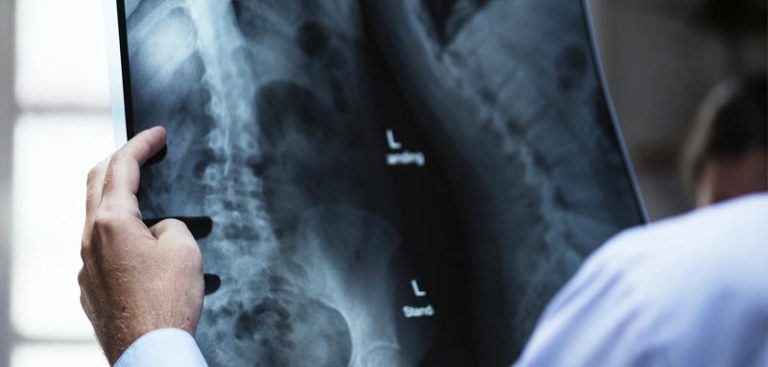 Ein Arzt, der ein Röntgenbild vor sich hält. (c) Pixabay.com