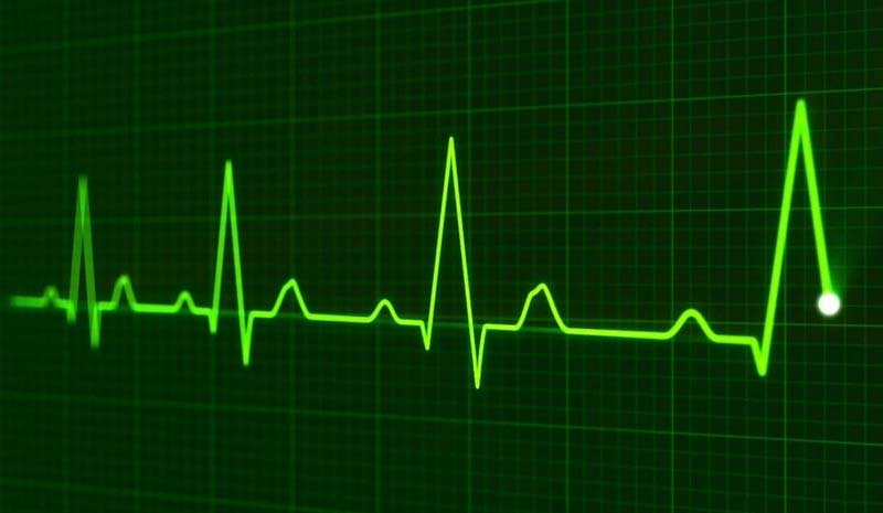 Eine grüne Herzlinie eines EKGs, Stichwort Gesundheitssystem.
(c) Pixabay.com