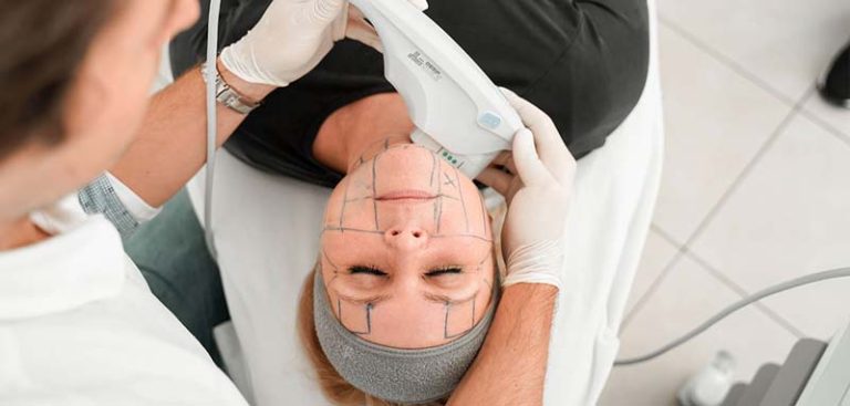 Das Gesicht einer Frau, die mit Ultherapy behandelt wird. (c) OmniMed