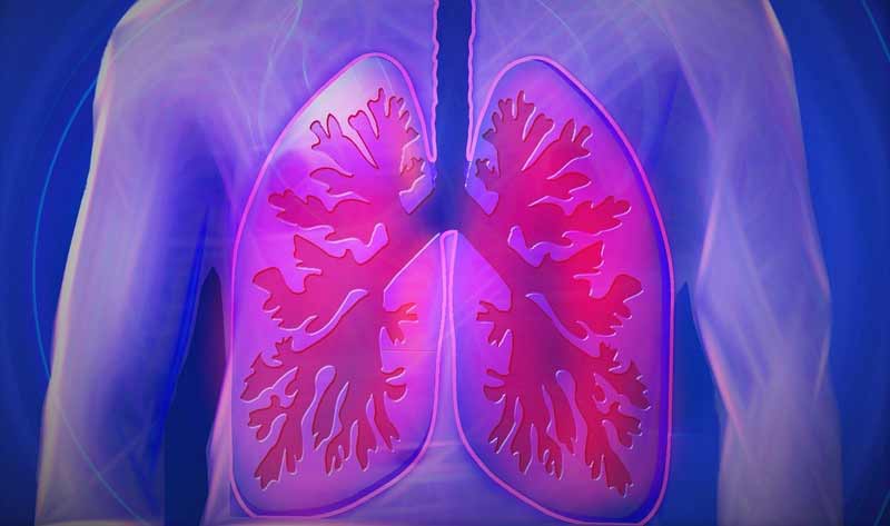 Pneumokokken-Impfung in diesem 'Covid-19-Jahr' wichtiger denn je 1 Illustration: Oberkörper und Lungenflügel eines Erwachsenen, Stichwort Pneumokokken.
(c) Pixabay.com