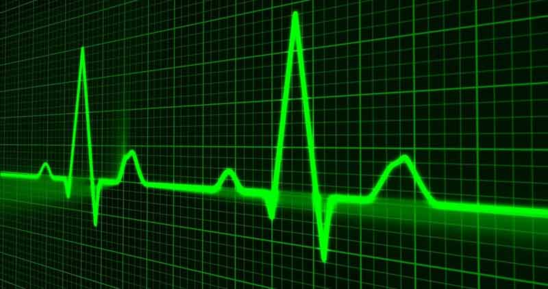 Eine grüne Herzschlaglinie auf einem EKG-Monitor.
(c) Pixabay.com