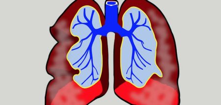 Illustration einer menschlichen Lunge. (c) Pixabay.com