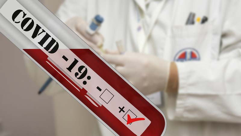 Eine Blutprobe mit einem positiven Covid-19-Test, dahinter ein Arzt, Stichwort Maßnahmenpaket.
(c) Pixabay.com