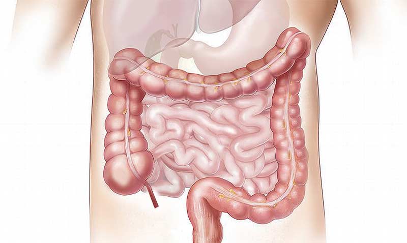 Grafik: Torso eines Mannes mit Visualisierung des Darms, Stichwort Darmkrebsvorsorge.
(c) Pixabay.com