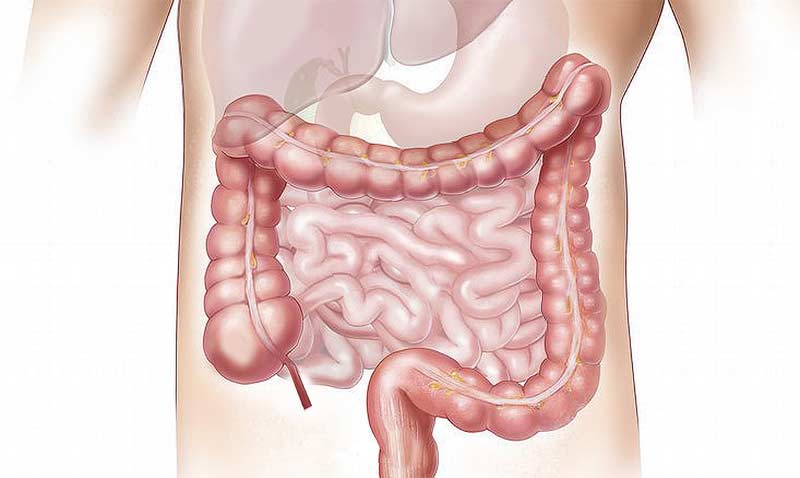 Don't wait – warten sie trotz Corona nicht mit der Darmkrebsvorsorge 1 Grafik: Torso eines Mannes mit Visualisierung des Darms, Stichwort Darmkrebsvorsorge.
(c) Pixabay.com