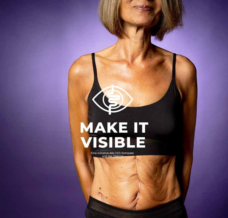 Der Bauch einer älteren Frau im Rahmen der Kampagne #makeitvisible.
(c) CED-Kompass/ Barbara Wirl – wirlphoto