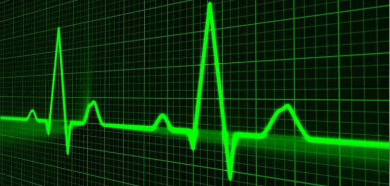 Die Herzschlaglinie eines EKGs. (c) Pixabay.com
