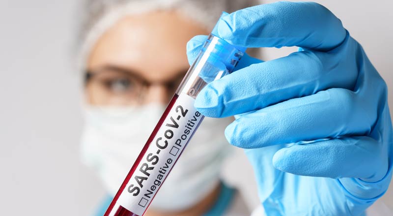 Eine Forscherin mit blauen Handschuhen hält eine Blutprobe mit der Aufschrift SARS-CoV-2.
(c) AdobeStock