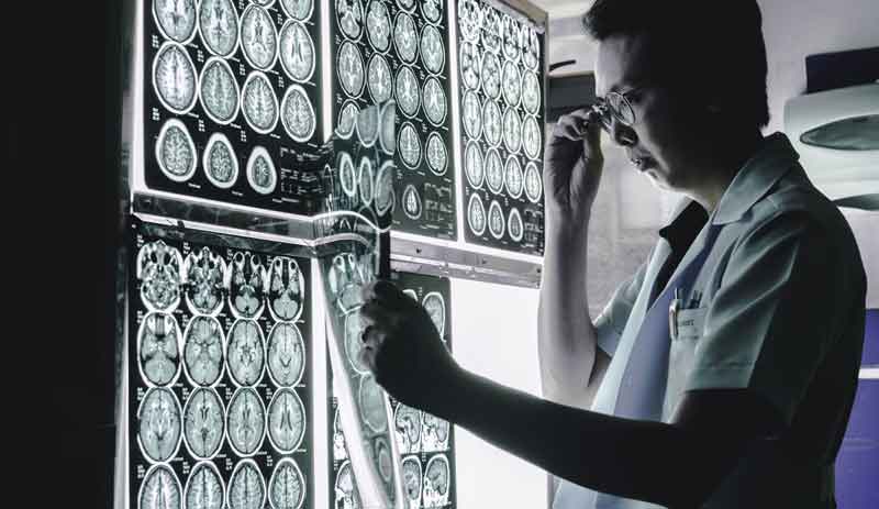 Ein Mediziner, der sich Gehirnscans anschaut, Stichwort Ultraschall bei Demenz.
(c) AdobeStock