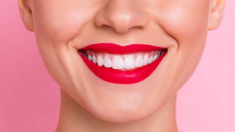 Der lachende Mund einer Frau mit weißen Zähnen und roten Lippen. (c) AdobeStock