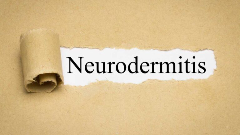 Das Wort Neurodermitis unter einem aufgerissenen Blatt. (c) AdobeStock