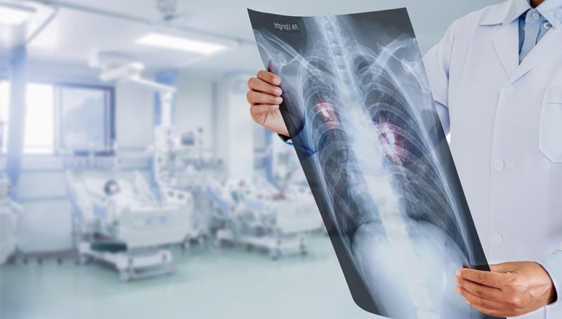 Krebs im Alter: Krebsreport 2025 zeigt neue Wege für Österreich 1 Die Hände eines Arztes, de sich ein Röntgenbild anschaut, Stichwort Krebs im Alter.(c) AdobeStock