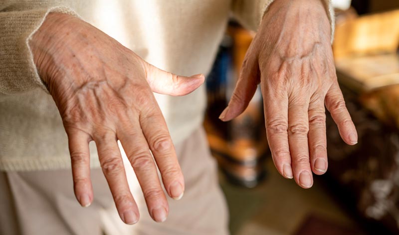 Parkinson Therapie in Österreich: Der stille Durchbruch gegen den Kontrollverlust 1 Nahaufnahme der zitternden Hände einer älteren Person, die in der Luft gehalten werden, mit Fokus auf die Hautstruktur und die Anspannung der Finger, Stichwort Parkinson Therapie in Österreich.
(c) AdobeStock