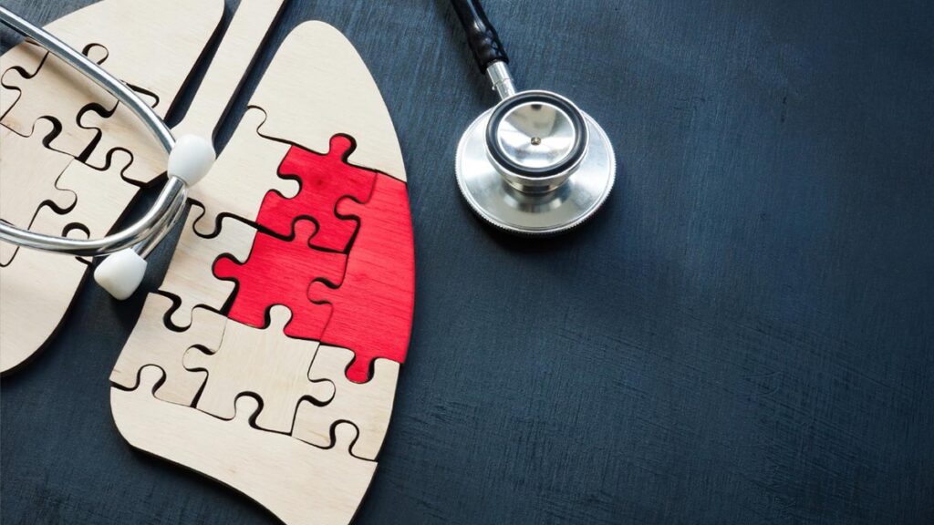 Ein hölzernes Modell einer menschlichen Lunge in Puzzle-Form auf dunklem Hintergrund, daneben liegt ein Stethoskop. Ein Teil der Lunge ist durch rote Puzzleteile hervorgehoben. (c) AdobeStock